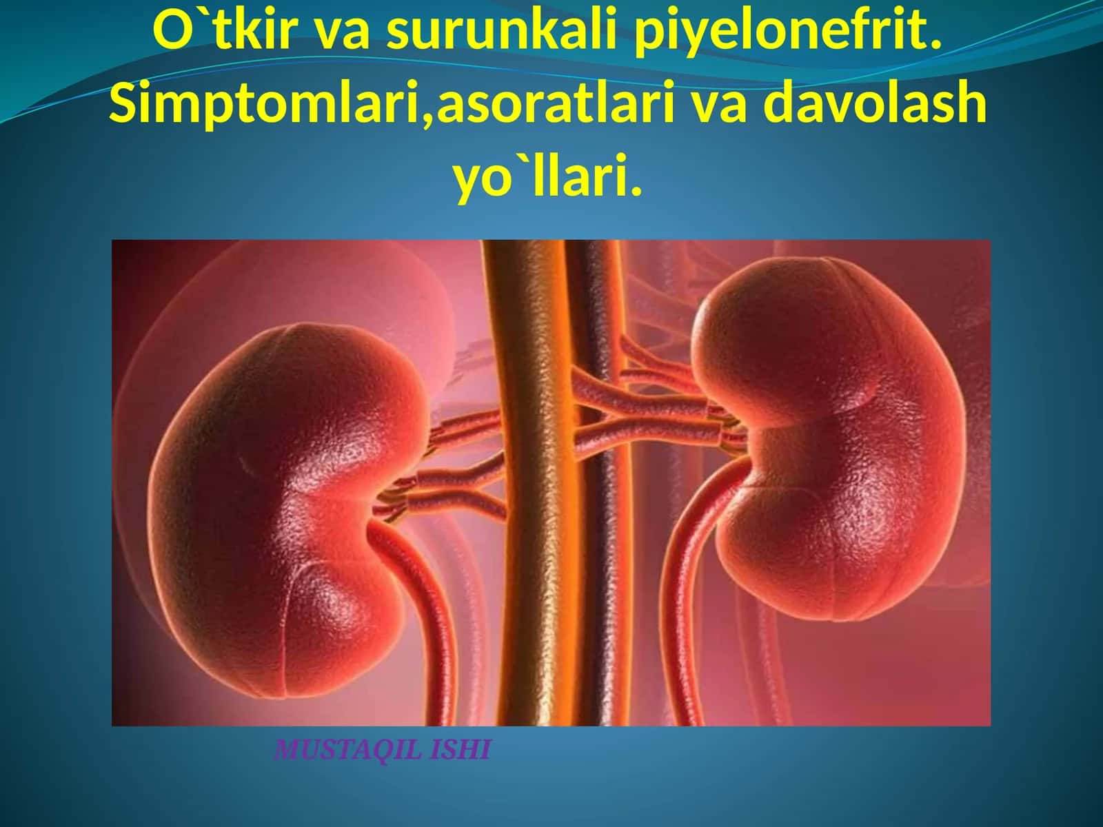O`tkir va surunkali piyelonefrit. Simptomlari, asoratlari va davolash yo`llari 1