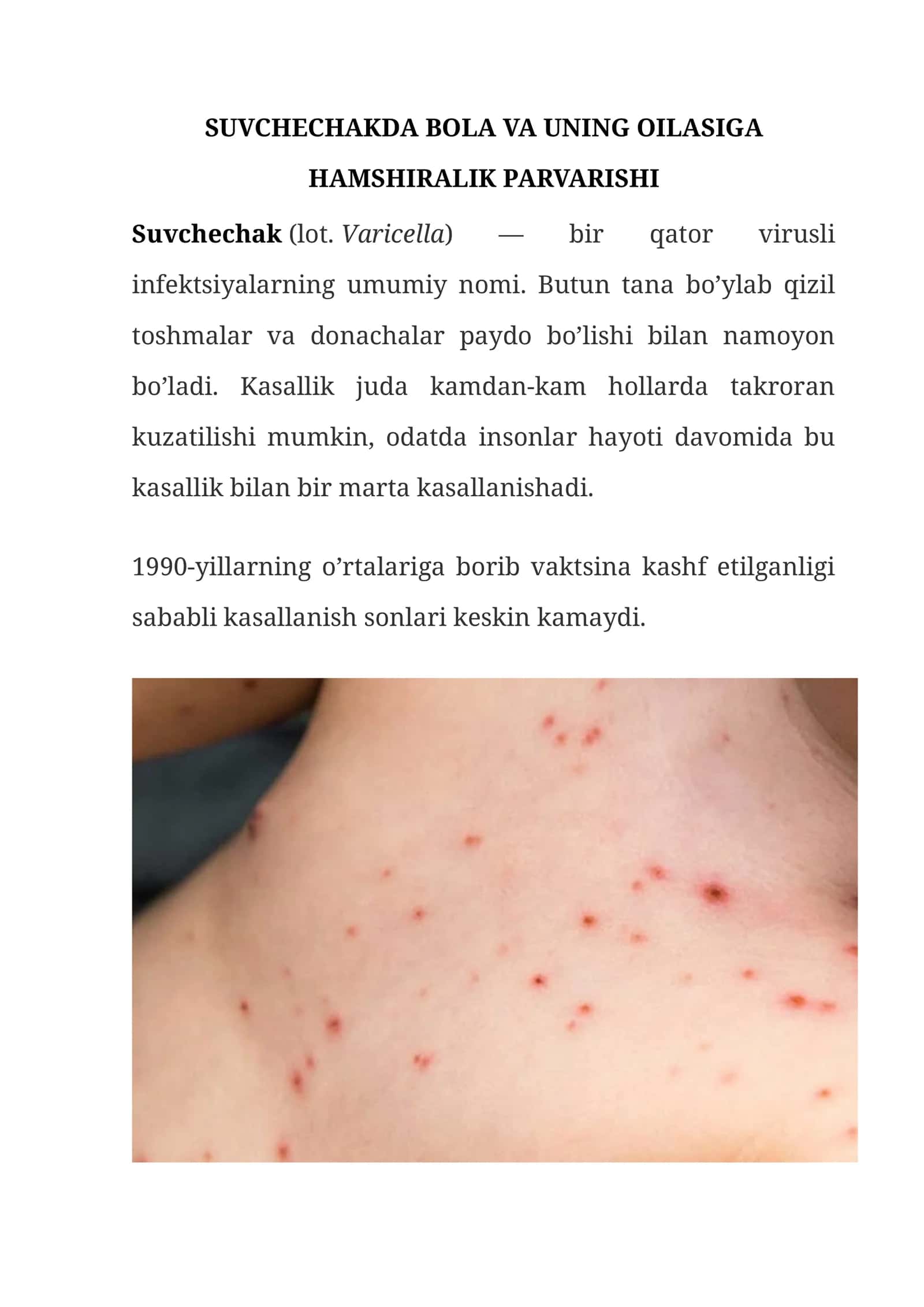 Suvchechakda bola va uning oilasi 1