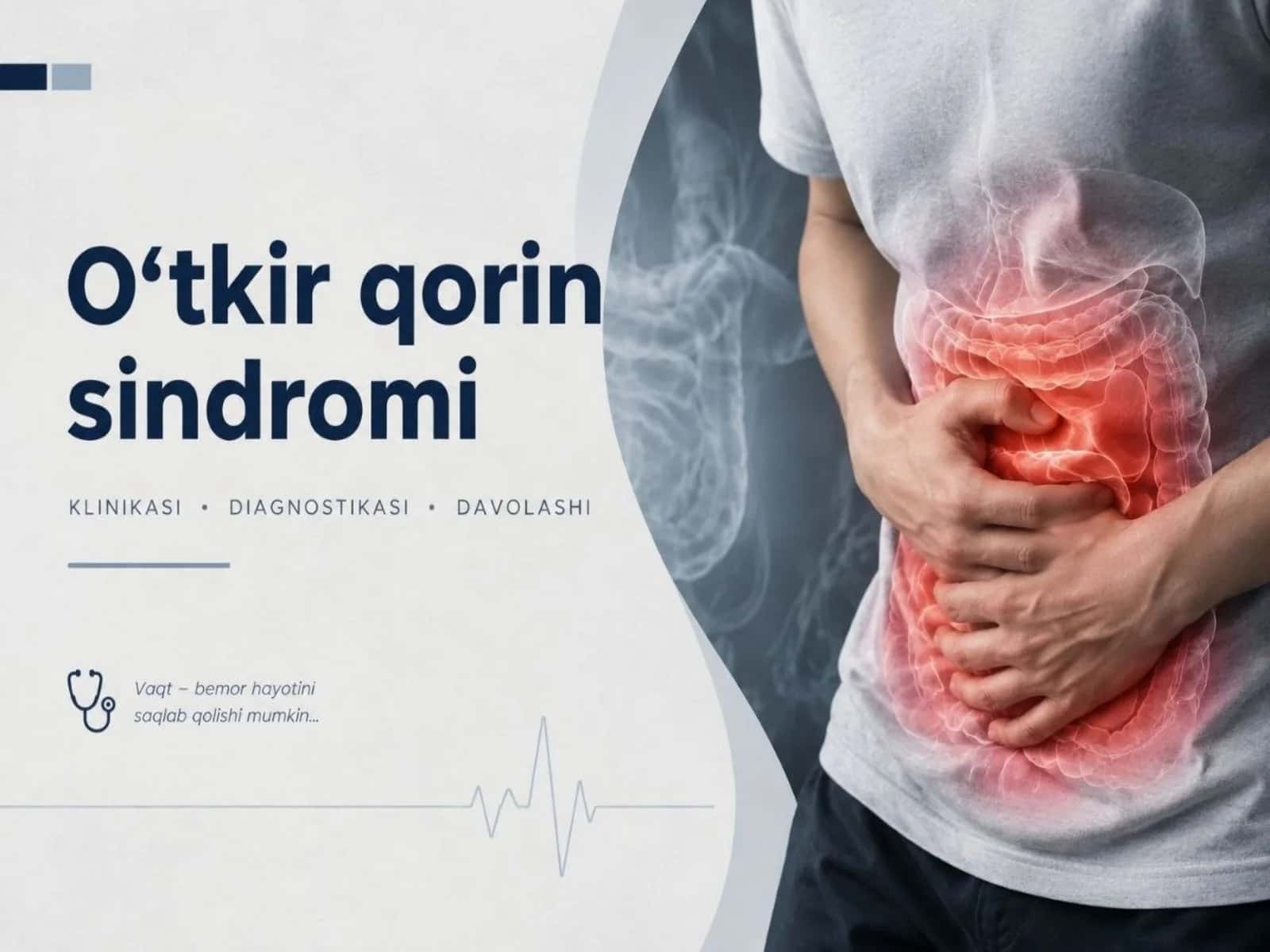 O'tkir qorin sindromi: belgilari, sabablari va davolash 1