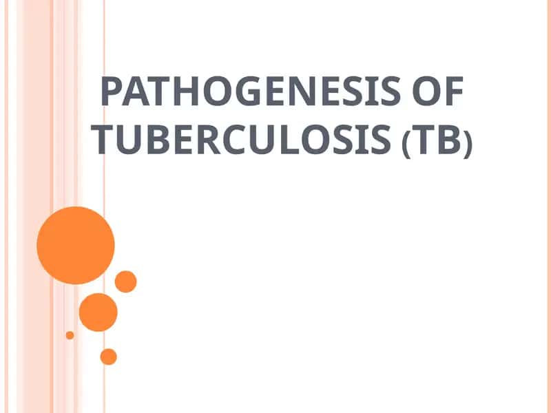 Tuberkuloz (SIL) 1