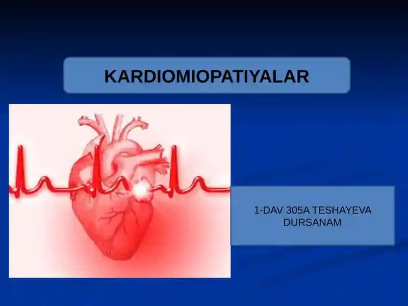 KARDIOMIOPATIYALAR