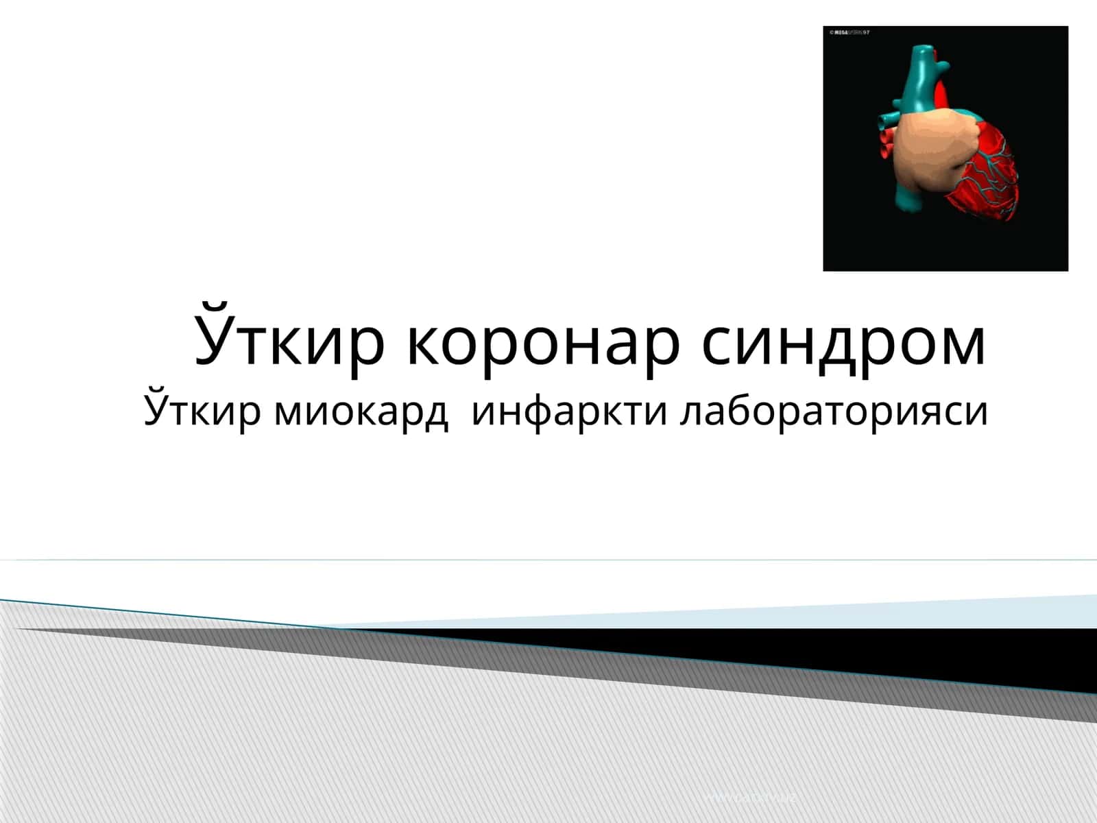 Ўткир коронар синдром 1