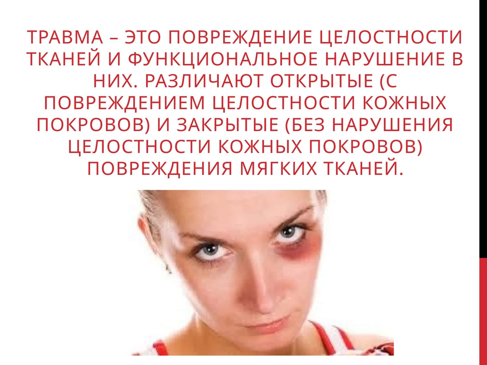 Травма 1