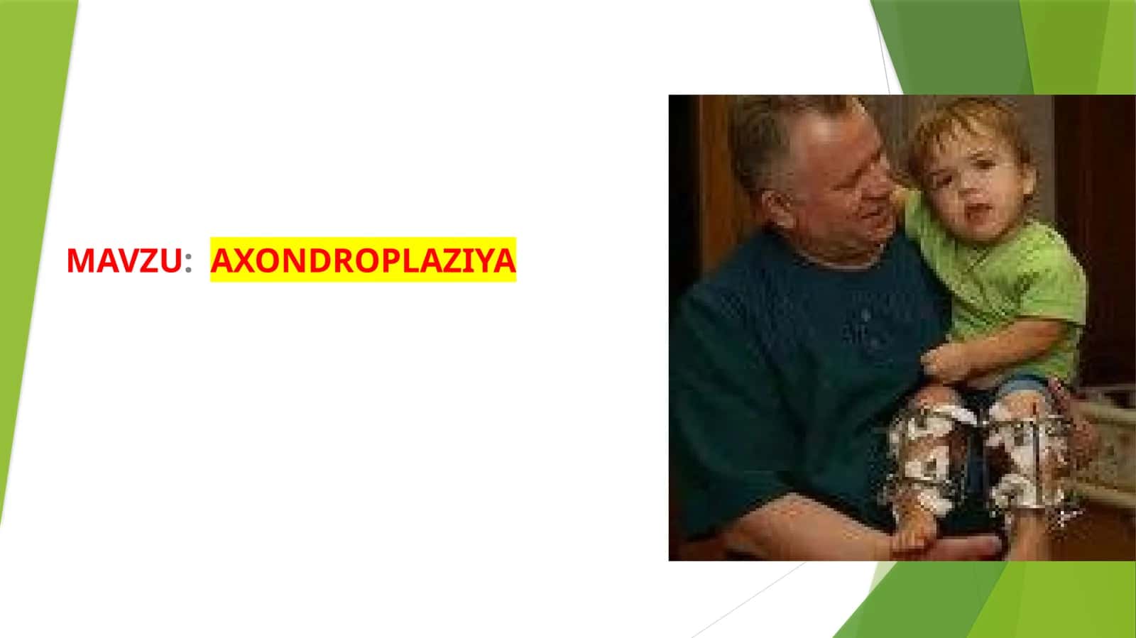 AXONDROPLAZIYA 1