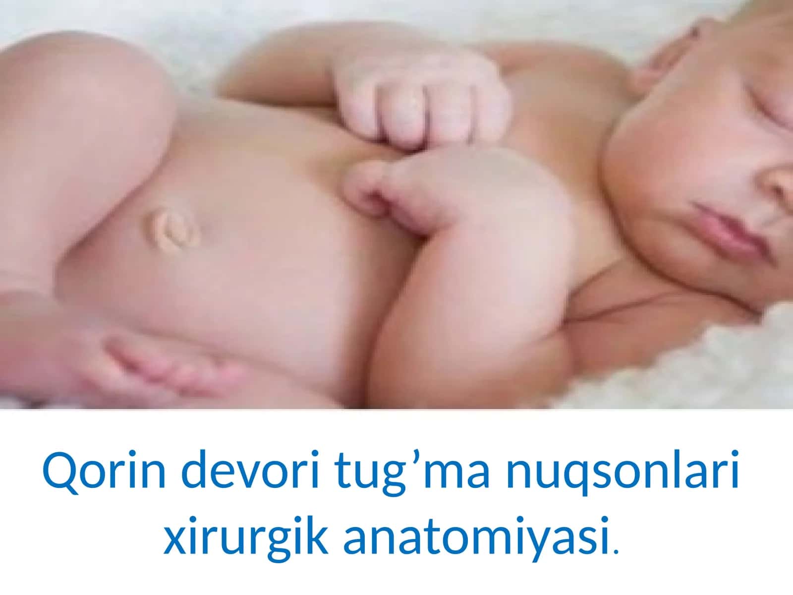 Qorindevori tug’ma nuqsonlari xirurgik anatomiyasi 1