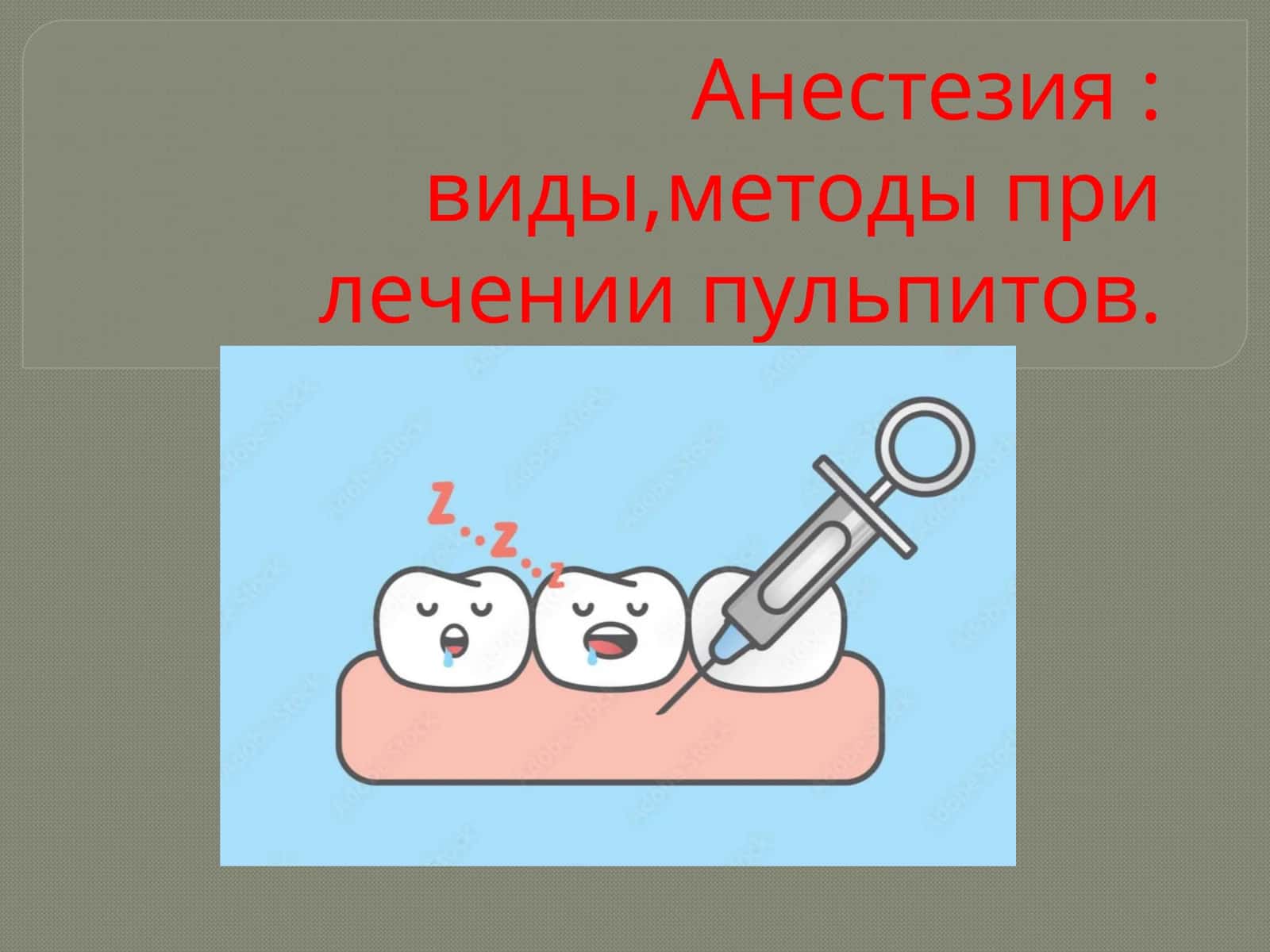 Анестезия: виды, методы при лечении пульпитов 1