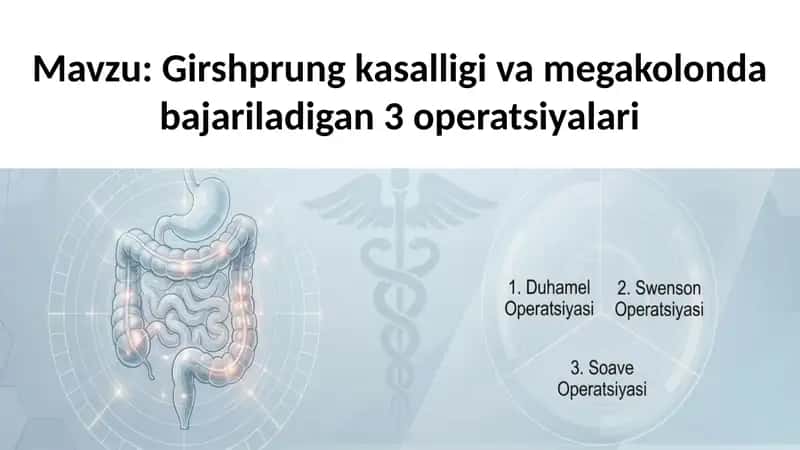 Girshprung kasalligi va megakolonda bajariladigan 3 operatsiyalar 1