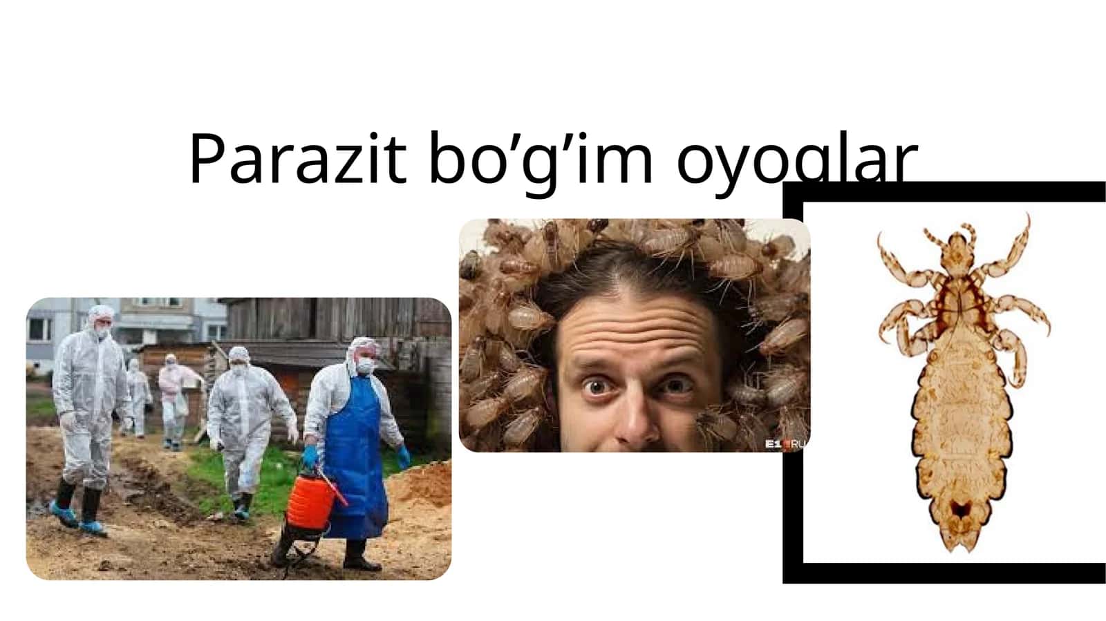 Parazitbo’g’imoyoqlar 1