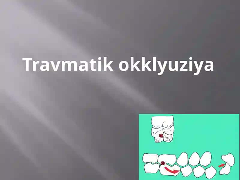 Travmatikokklyuziya 1