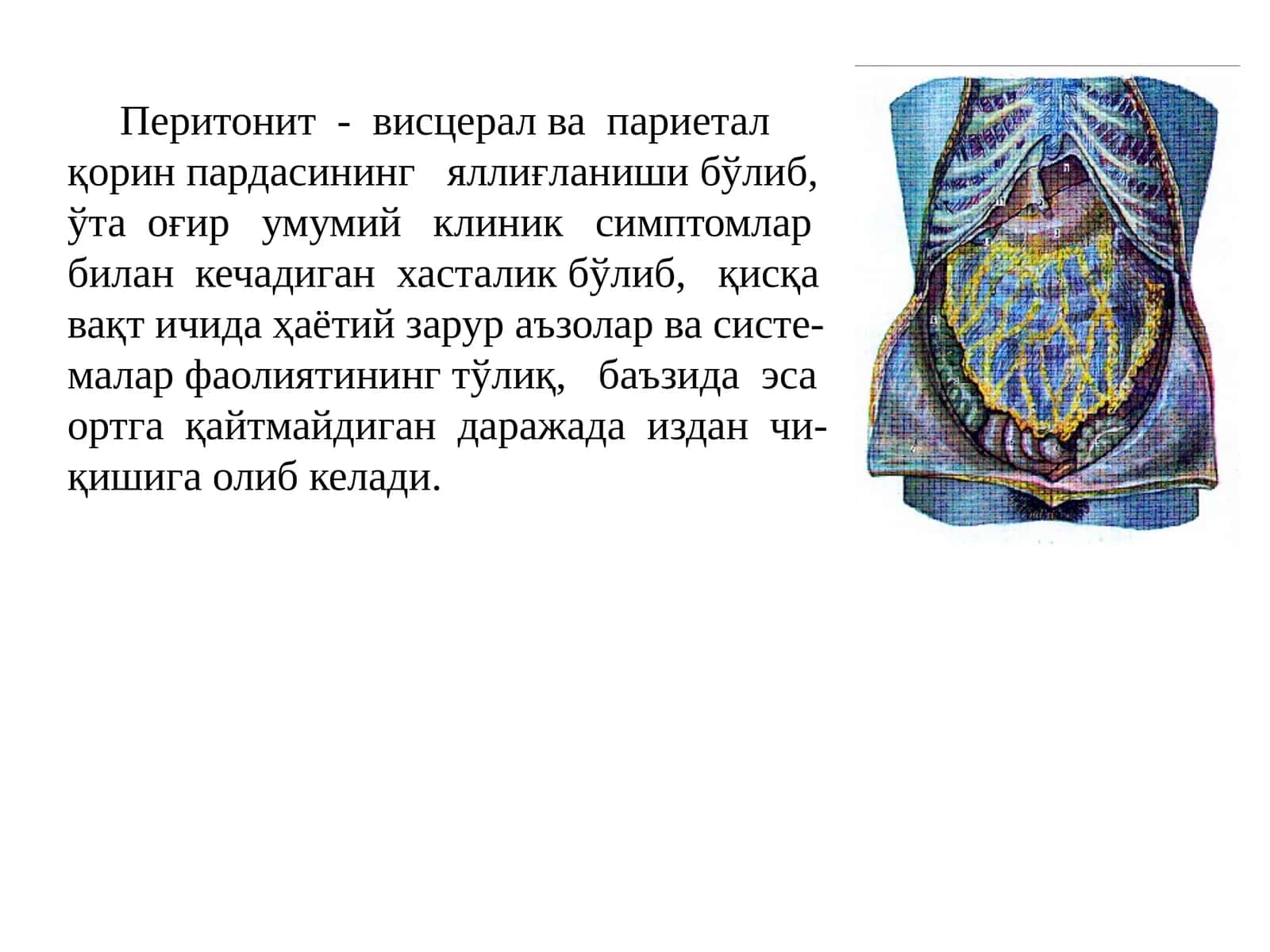 Перитонит-висцералвапариеталқорин пардасининг яллиғланиши 1