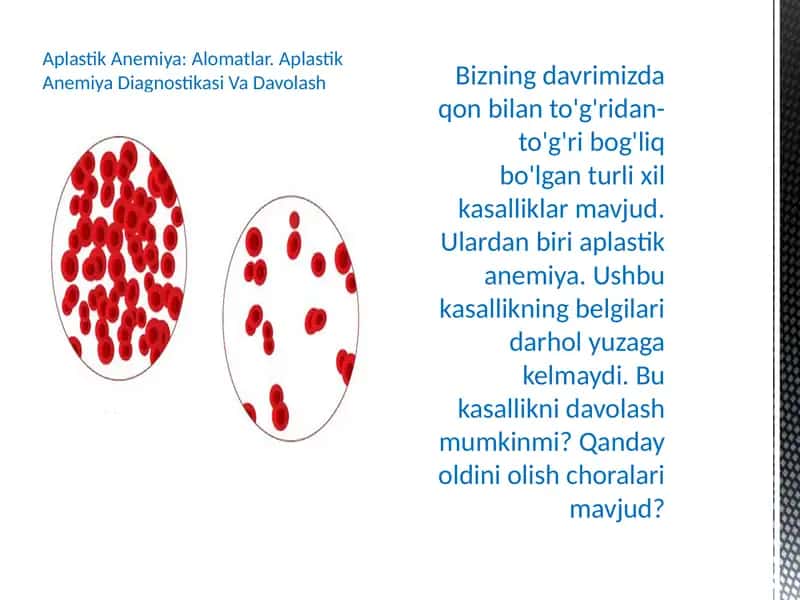 Aplastik Anemiya: Alomatlar. Aplastik Anemiya Diagnostikasi Va Davolash 1