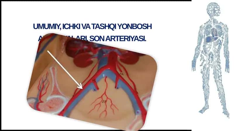 Umumiyyon bosh arteriyasi 1