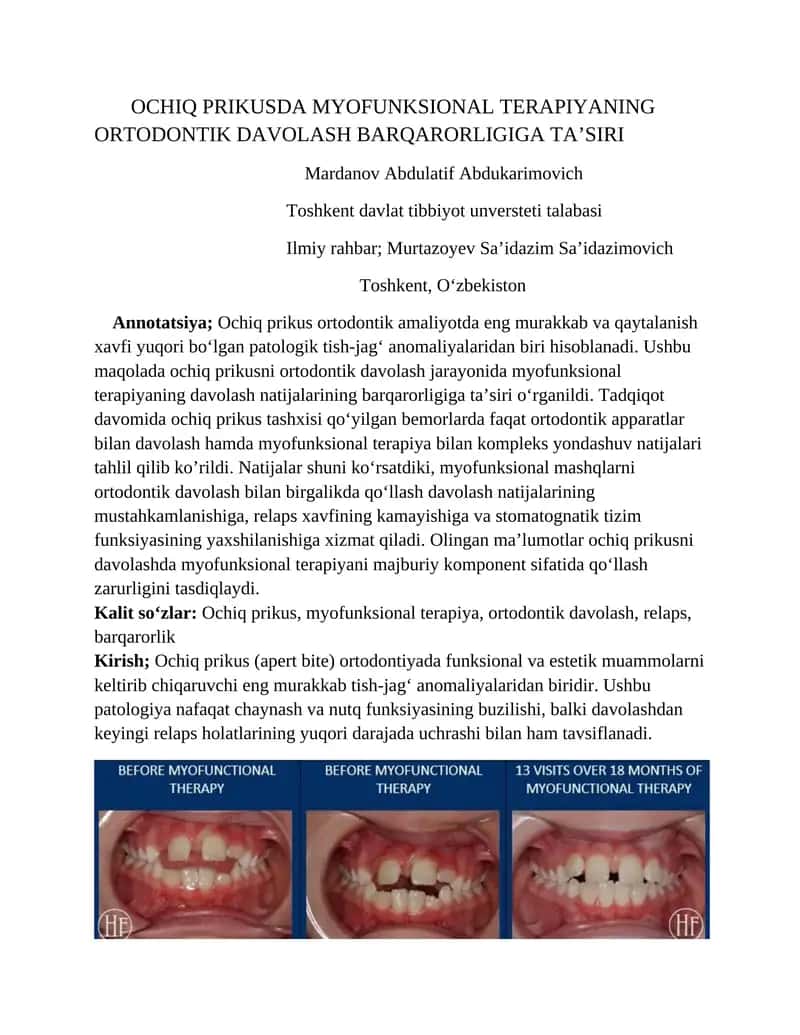 OCHIQ PRIKUSDA MYOFUNKSIONAL TERAPIYANING ORTODONTIK DAVOLASH BARQARORLIGIGA TA’SIRI 1