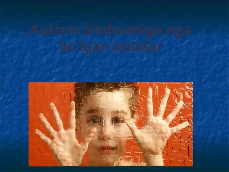 Autizm sindromiga ega bo‘lgan bolalar 1