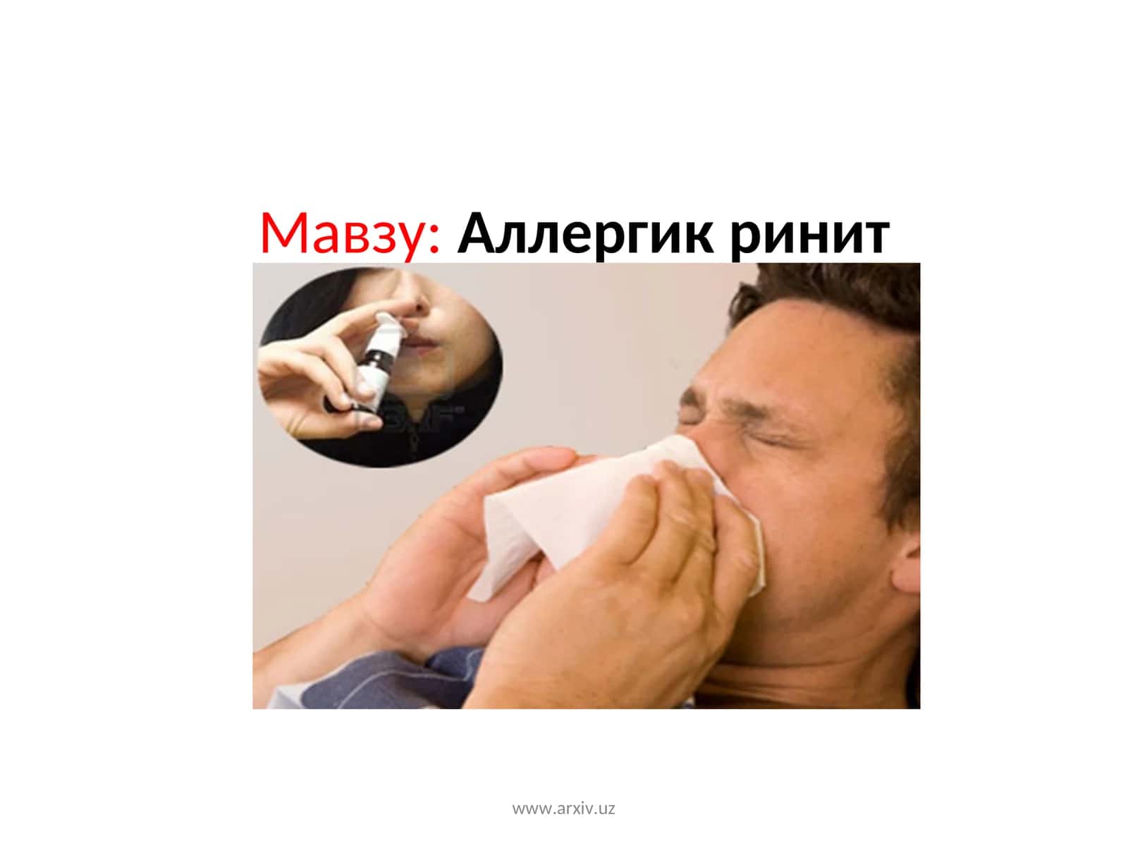 Аллергик ринит 1