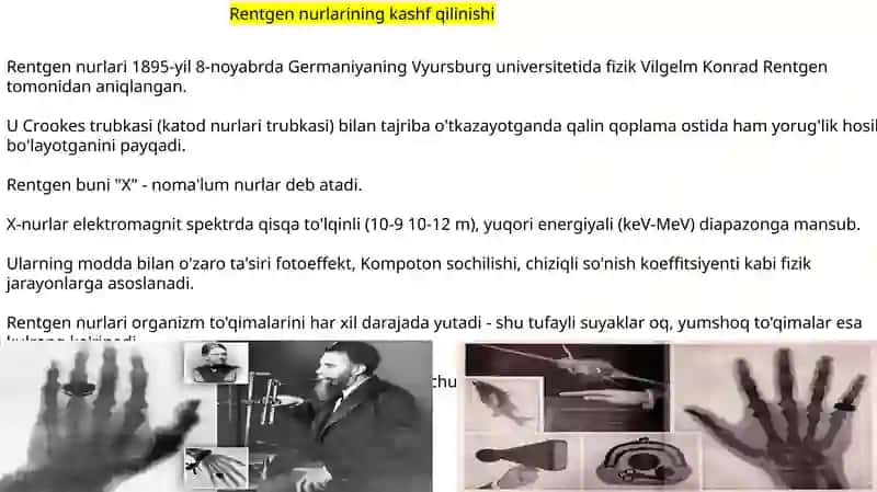 Rentgen_nurlarini_o'rganish_tarixi,_suyak_va_bo'g'imlar_rivojlanishini