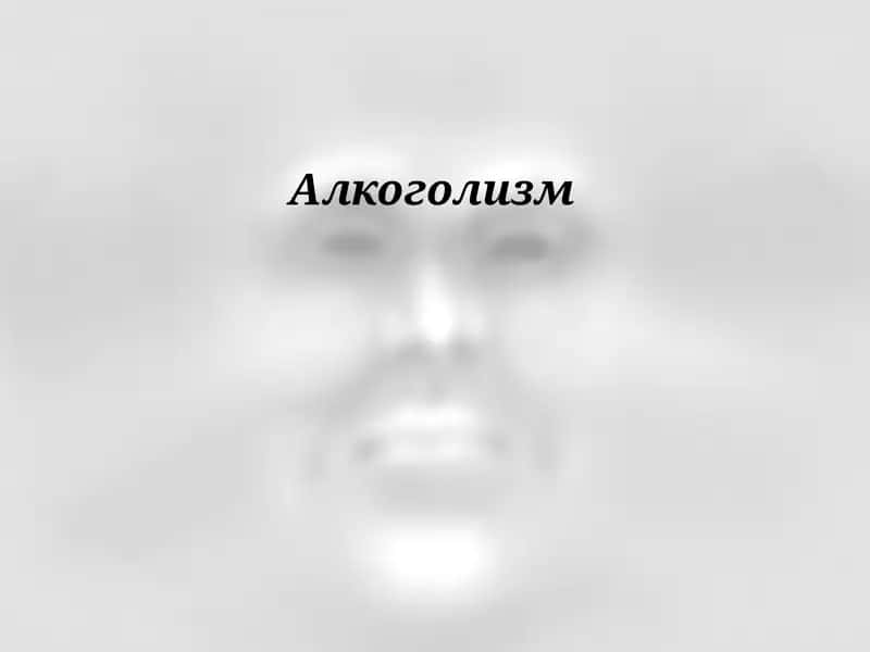 Алкоголизм . Alkogolizm slayd mustaqil ish 1