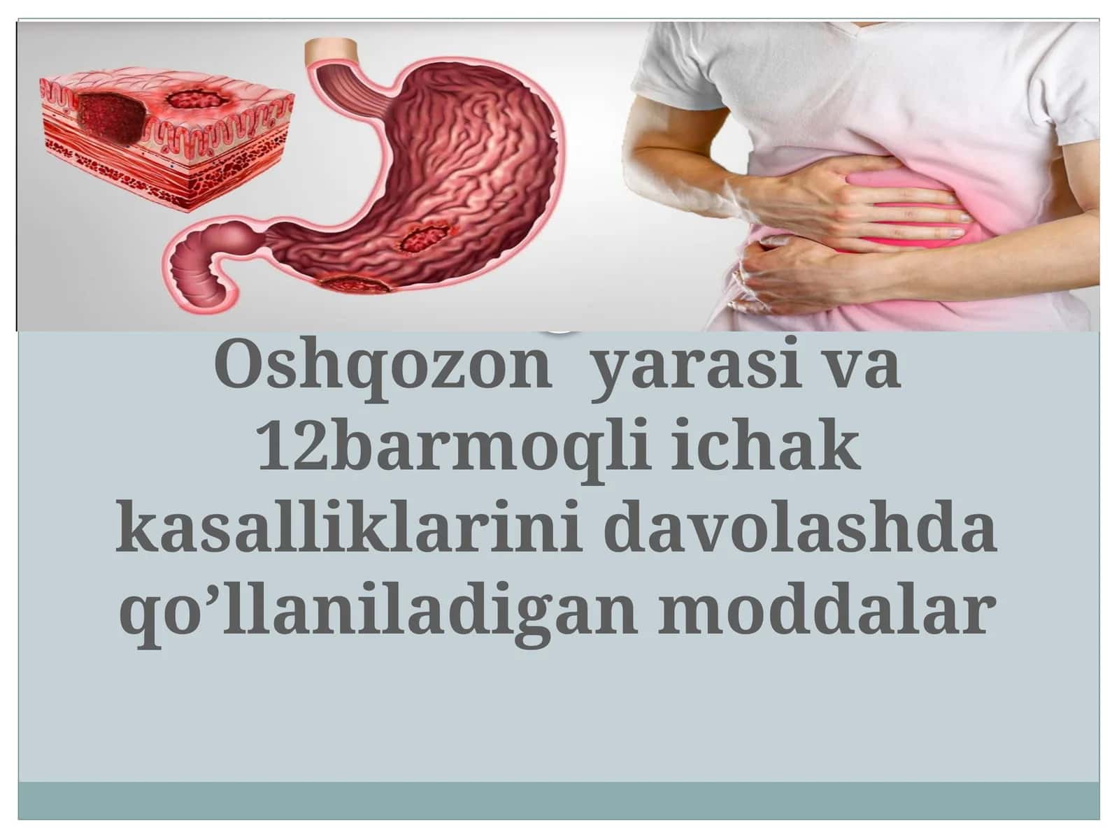 Oshqozon  yarasi va 12barmoqli ichak kasalliklarini davolashda qo’llaniladigan moddalarr 1