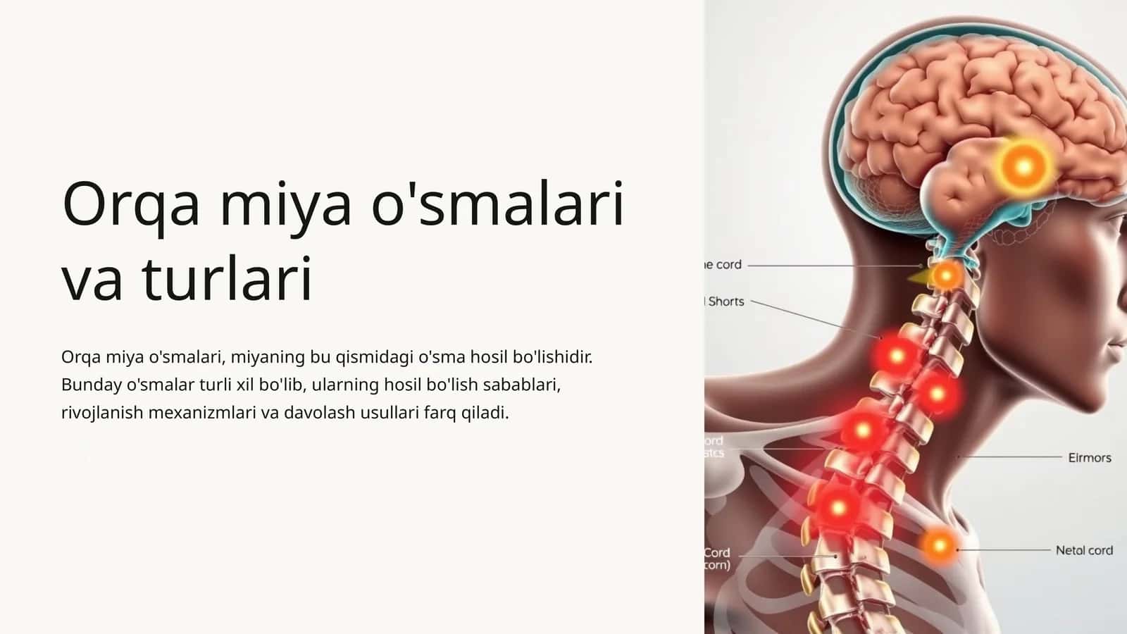 Orqa miya o'smalari va turlari 1