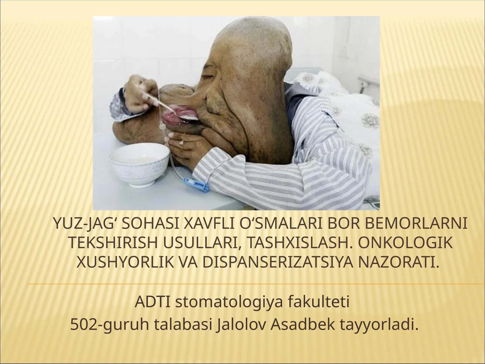 Yuz-jag‘ sohasi xavfli o‘smalari bor bemorlarni tekshirish usullari, tashxislash. Onkologik xushyorlik va dispanserizatsiya nazorati. 1