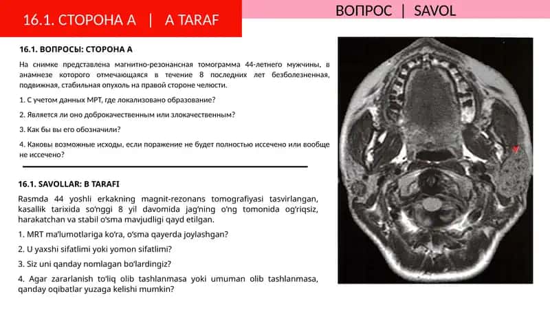 Магнитно-резонанс томограмма 1