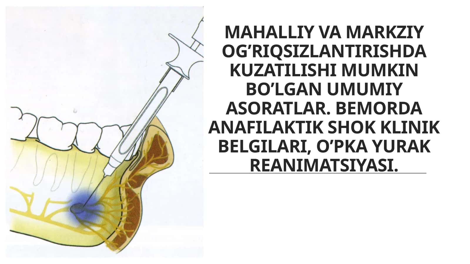 Stomatologiyada mahalliy va markaziy og‘riqsizlantirishda kuzatilishi mumkin bo‘lgan umumiy asoratlar 1
