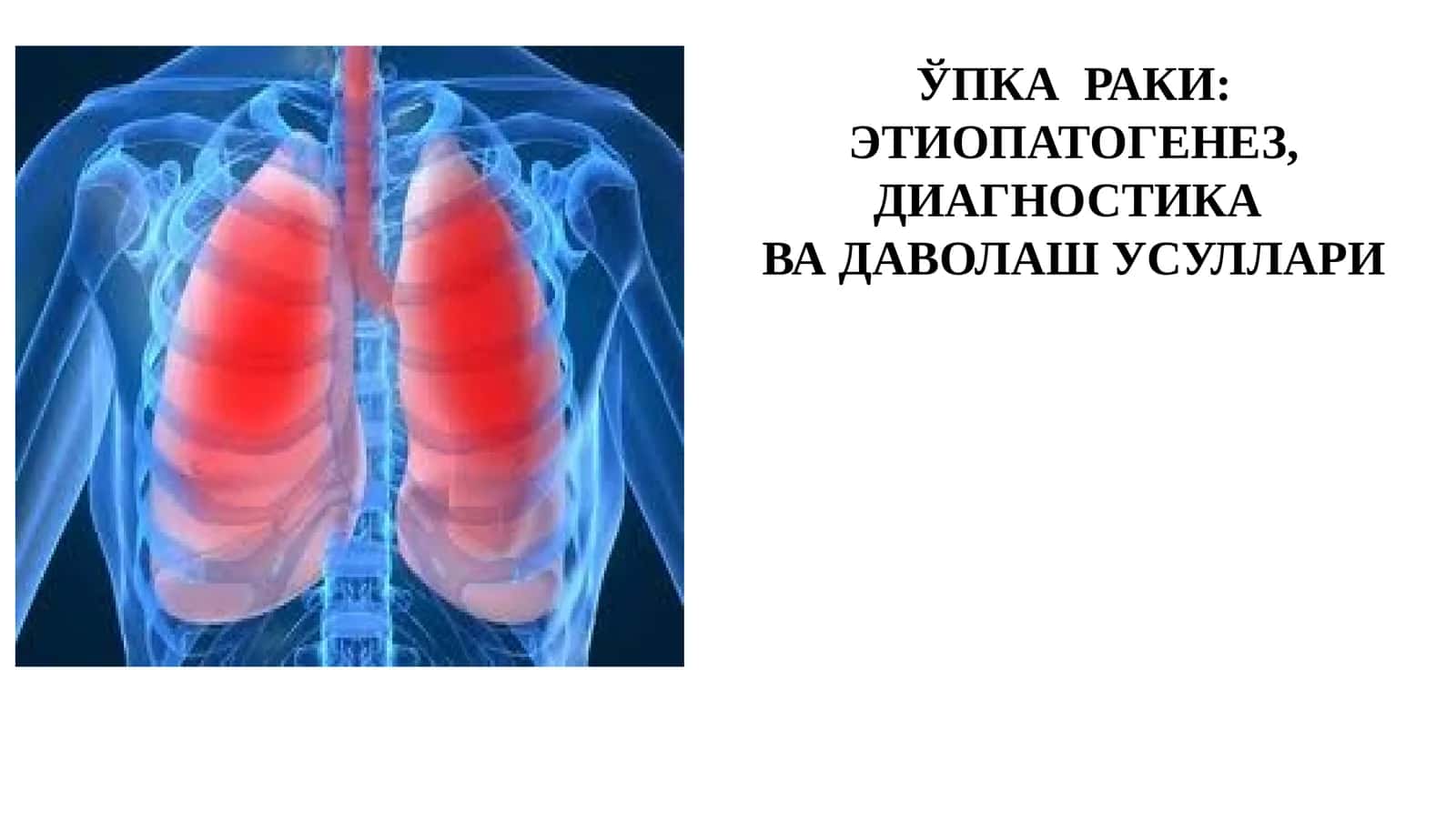 ЎПКА РАКИ 1