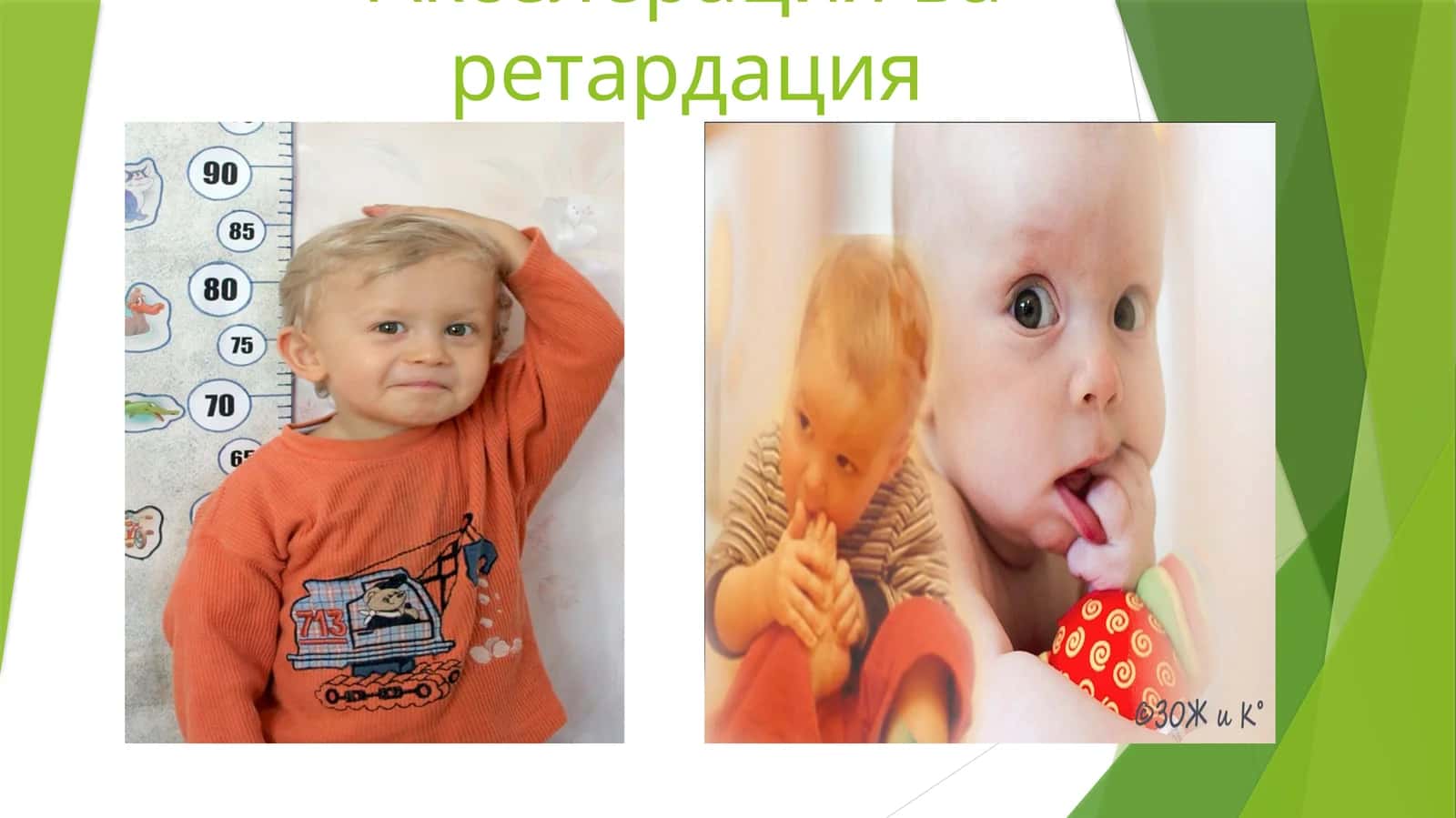 Акселерация ва ретардация 1