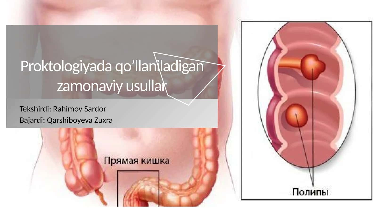 Proktologiyada qo’llaniladigan zamonaviy usullar 1
