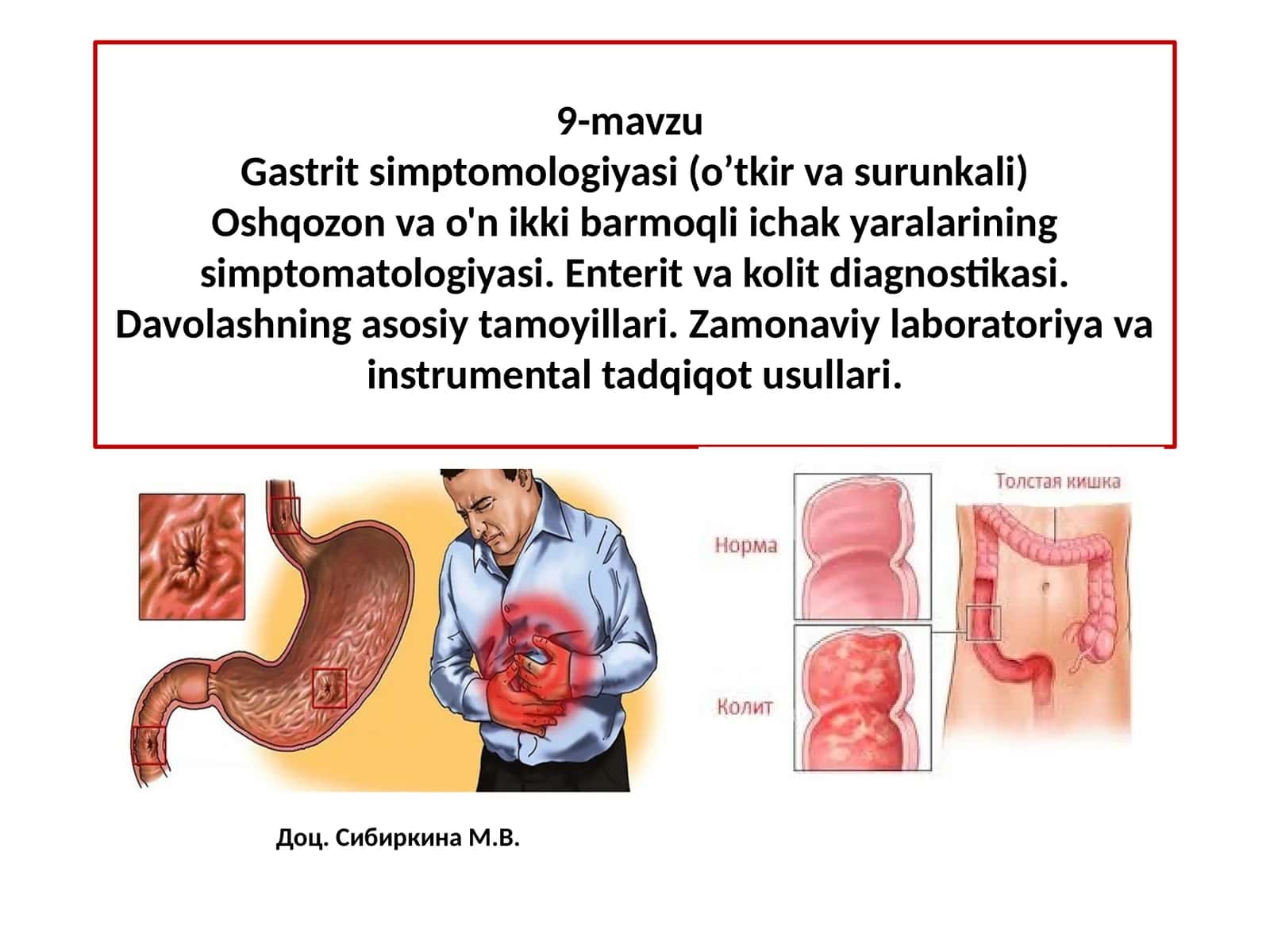 9-mavzuGastrit simptomologiyasi (o’tkir va surunkali) 1