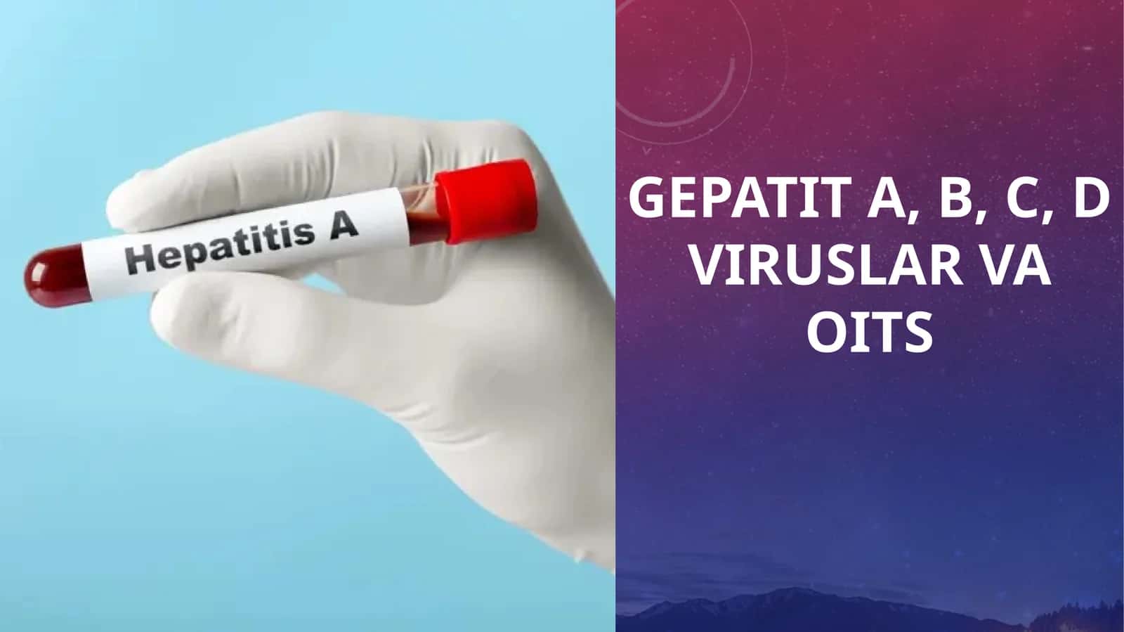 GEPATIT A, B, C, D VIRUSLAR VA OITS 1