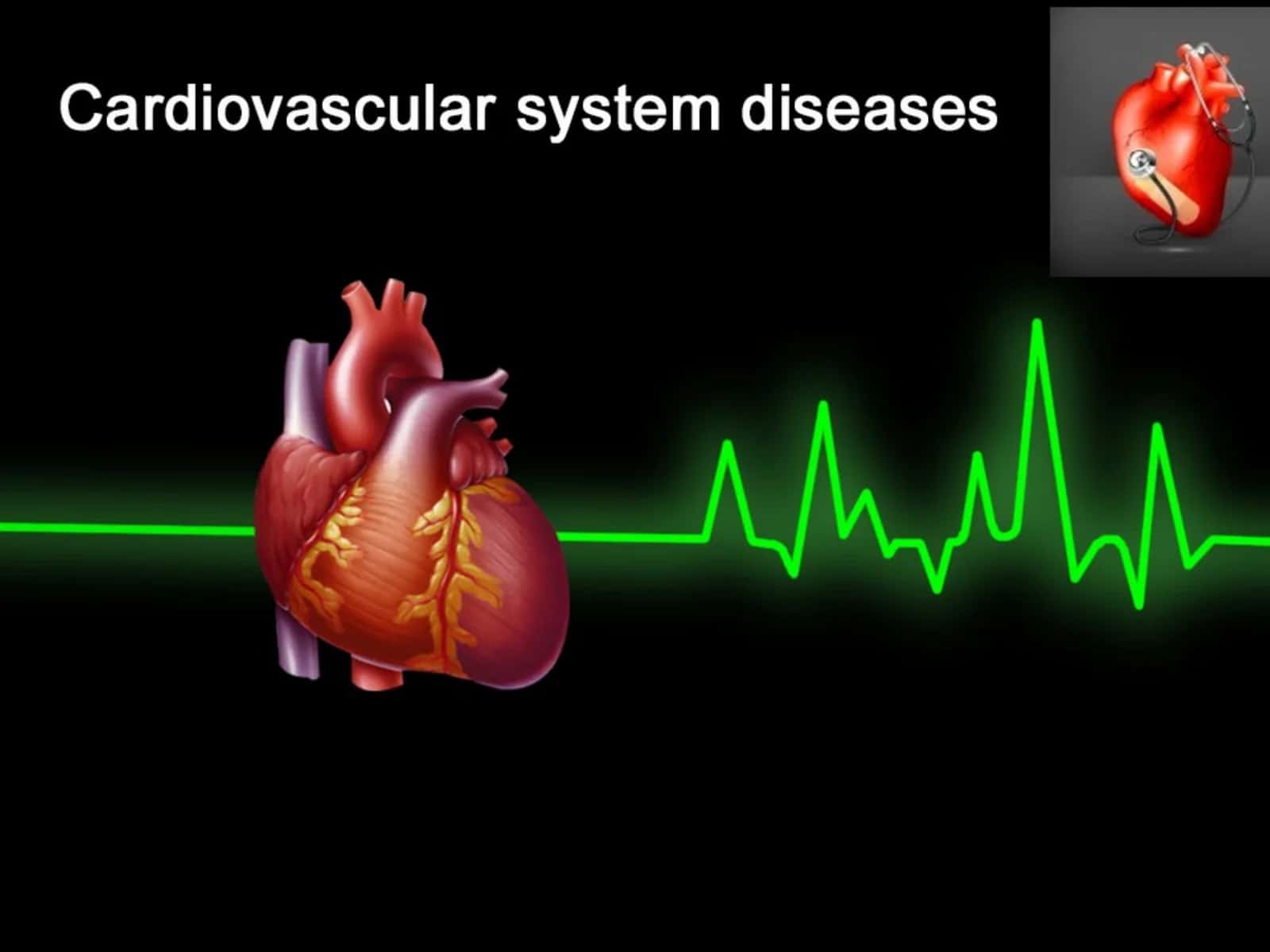 Angina Pectoris 1
