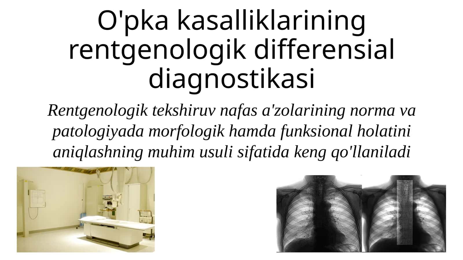 Rentgen bo'yicha differensial diagnostikasi 1