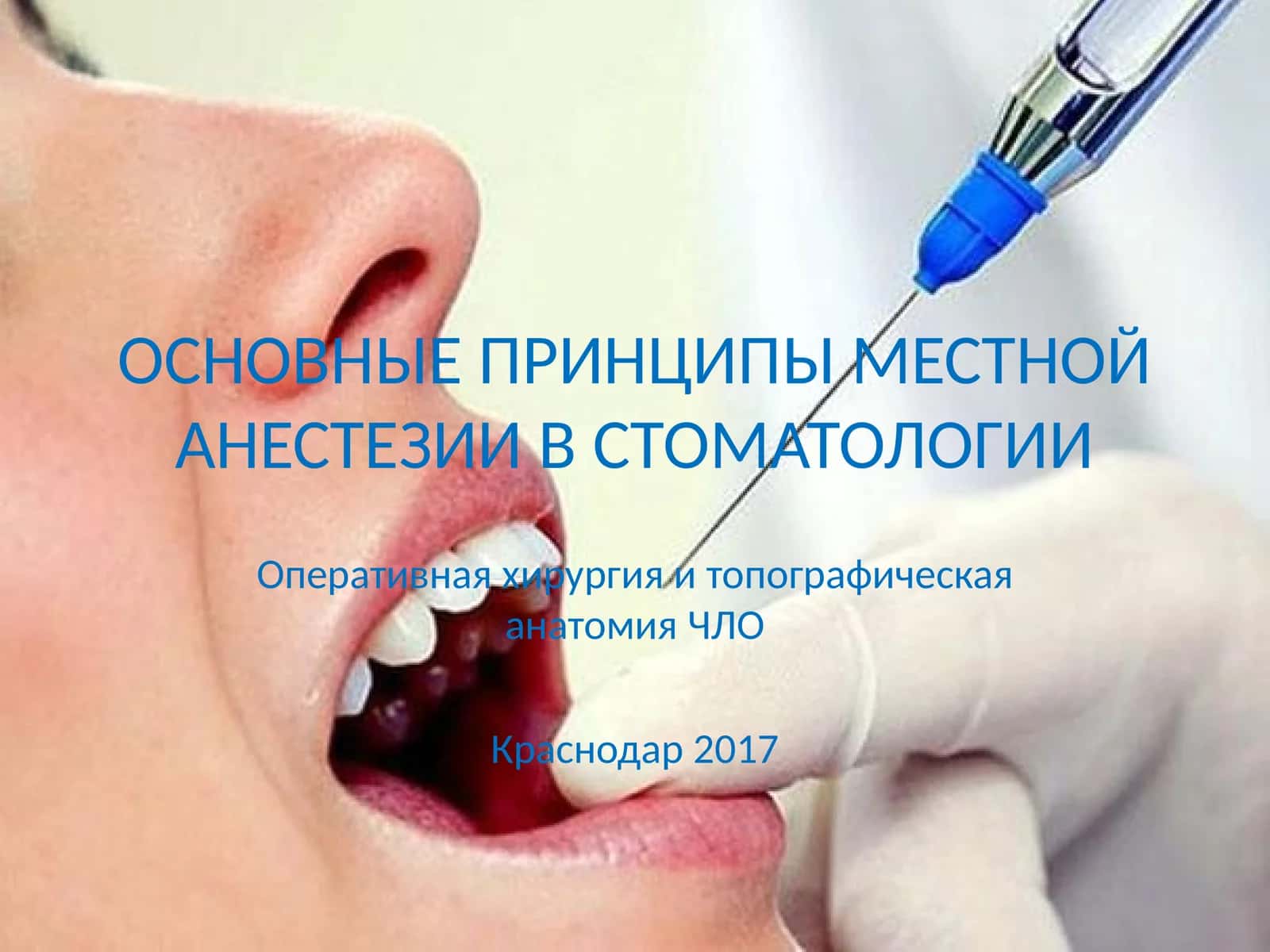 ОСНОВНЫЕ ПРИНЦИПЫ МЕСТНОЙ АНЕСТЕЗИИ В СТОМАТОЛОГИИ 1