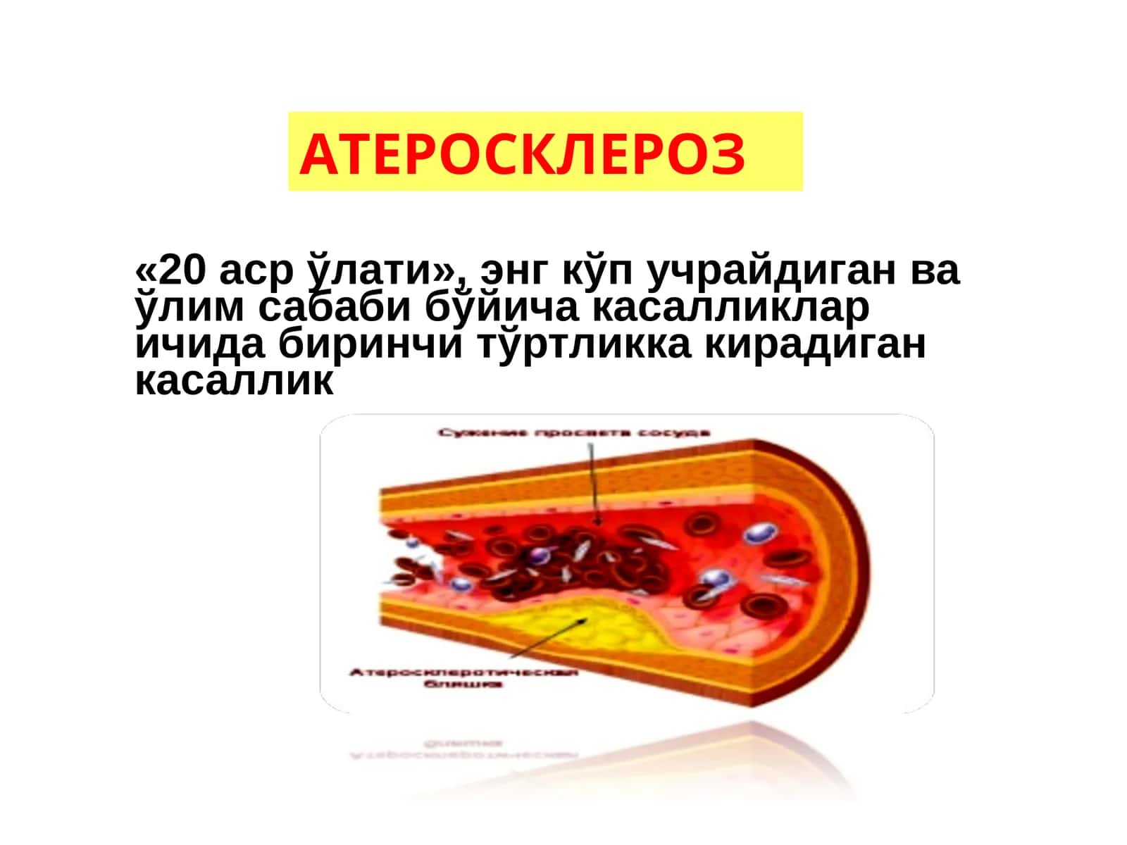 Атеросклероз 1