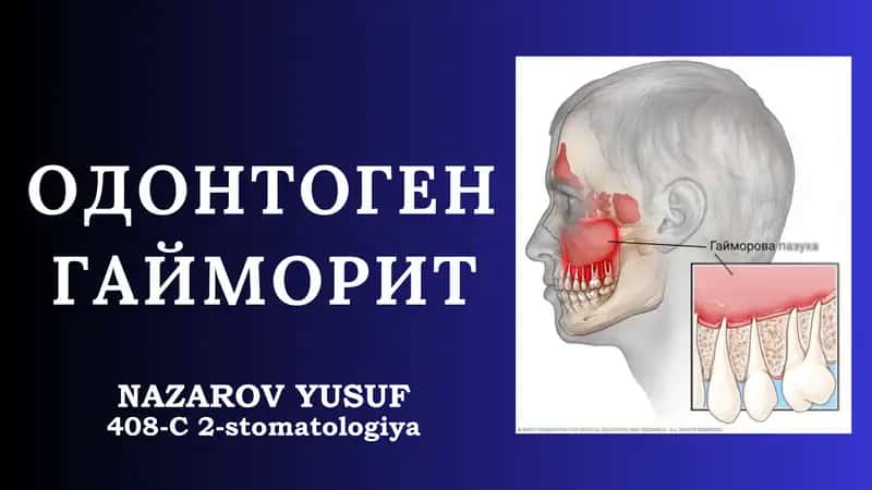 ODONTOGEN GAYMORIT 1
