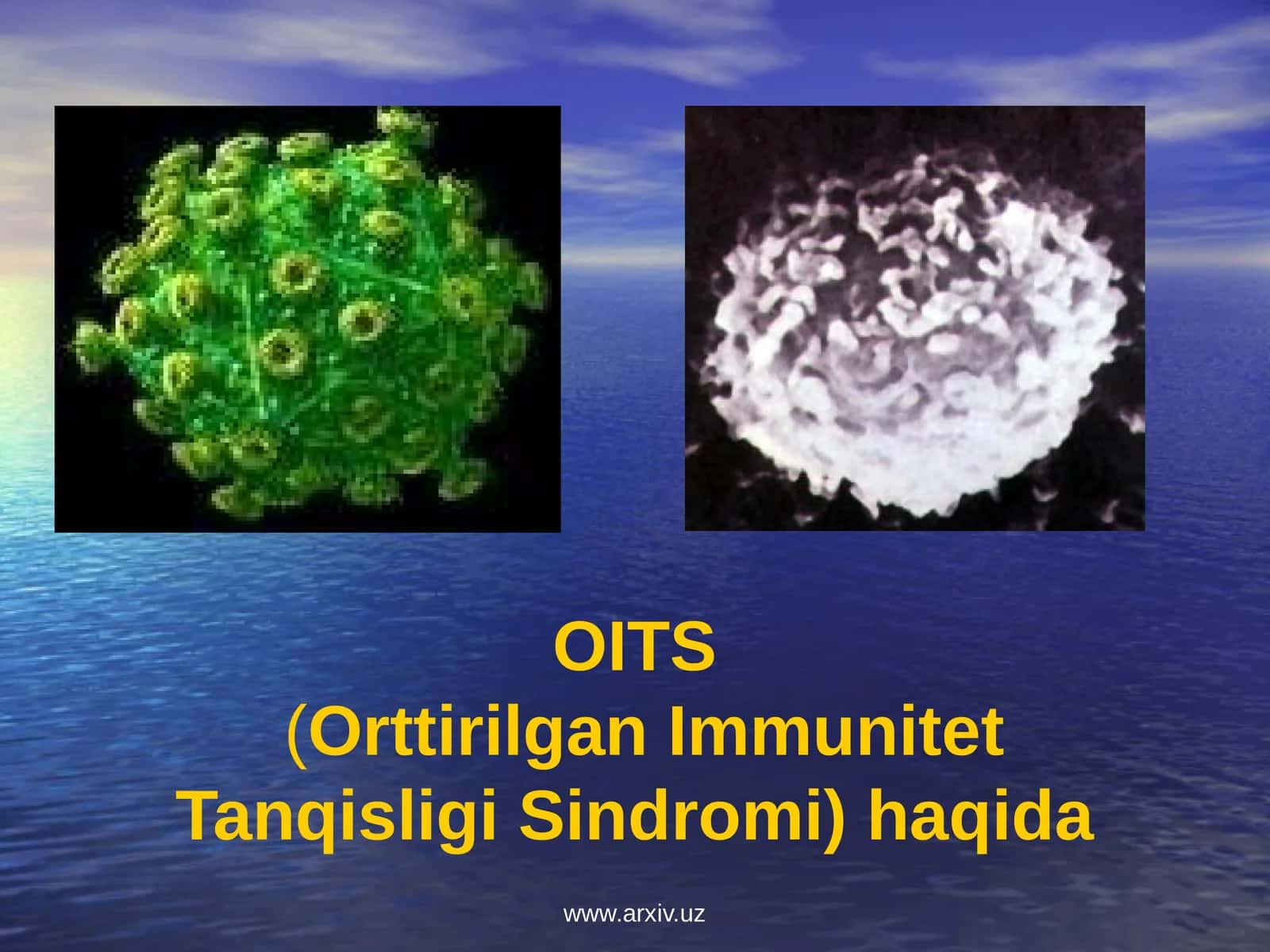 OITS(Orttirilgan Immunitet Tanqisligi Sindromi) haqida 1