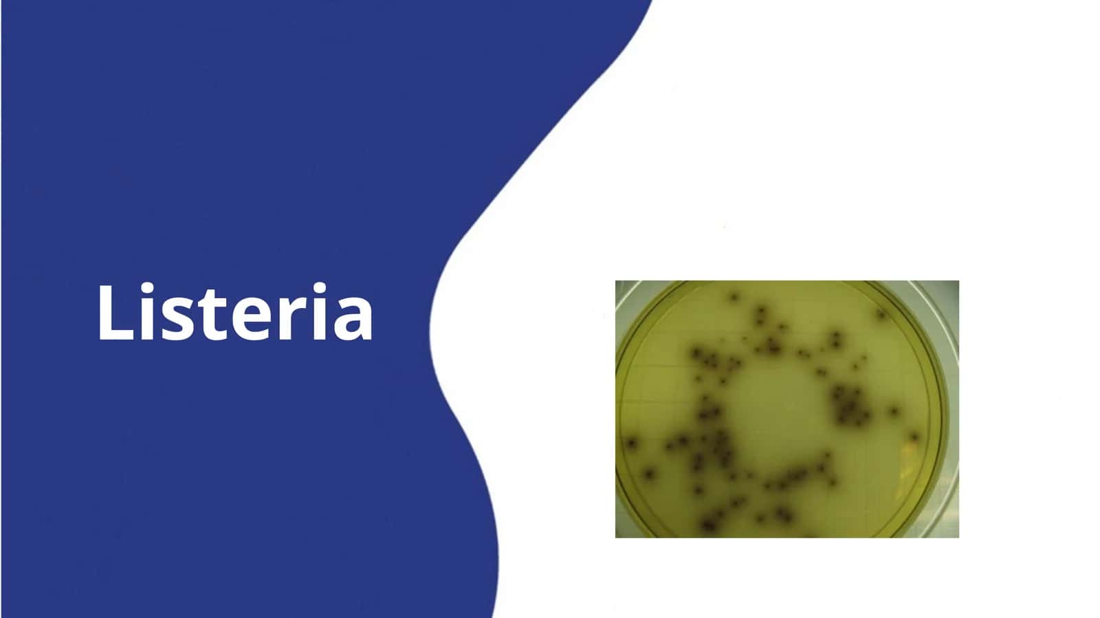 Listeria 1