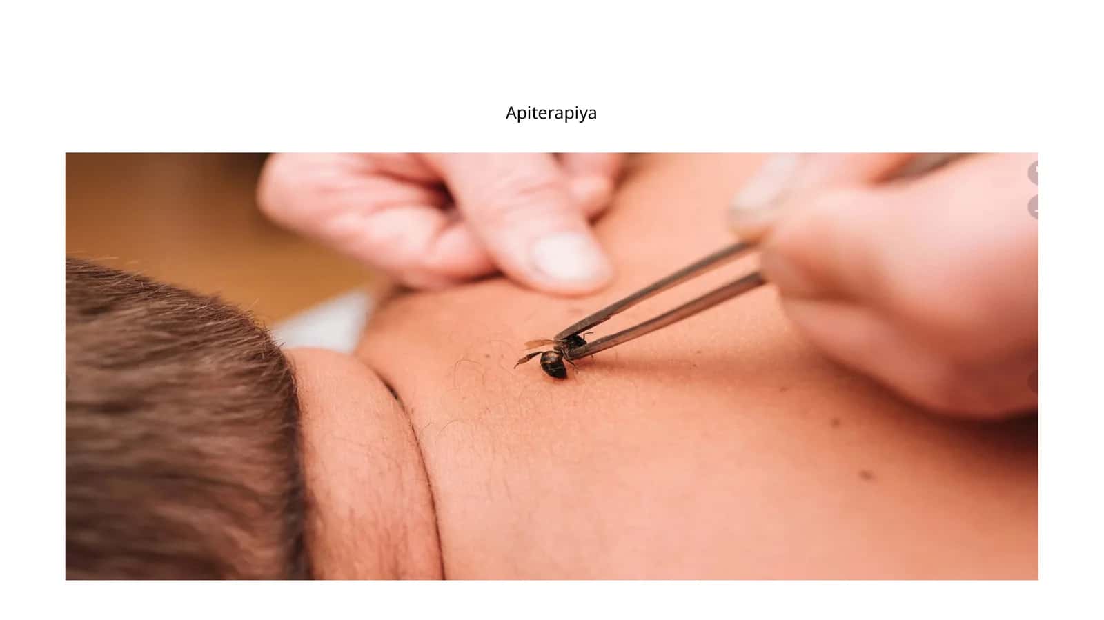 Apiterapiya 1