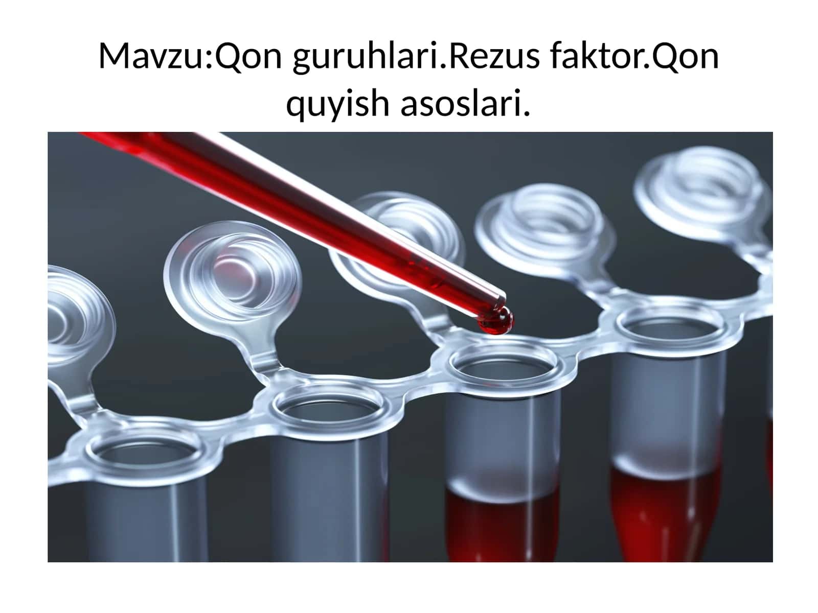 Qonguruhlari.Rezusfaktor.Qonquyishasoslari 1
