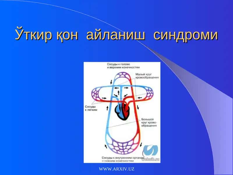 Ўткир қон айланиш синдроми 1