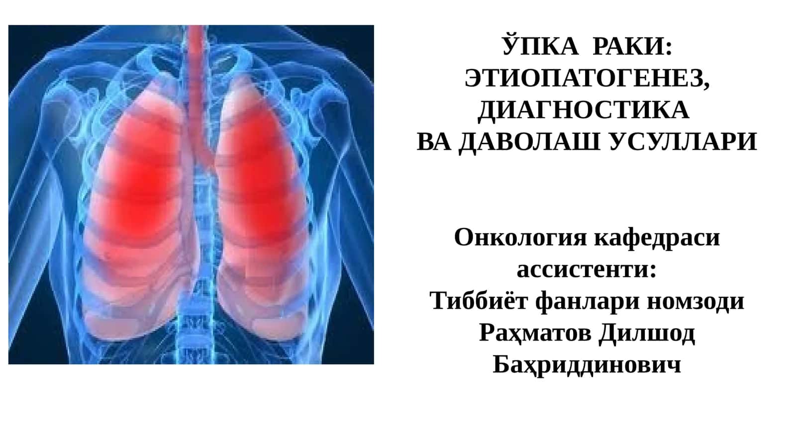 ЎПКА РАКИ 1