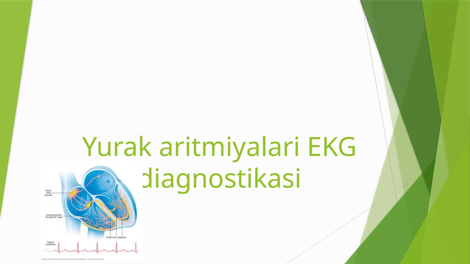YurakaritmiyalariEKG diagnostikasi 1