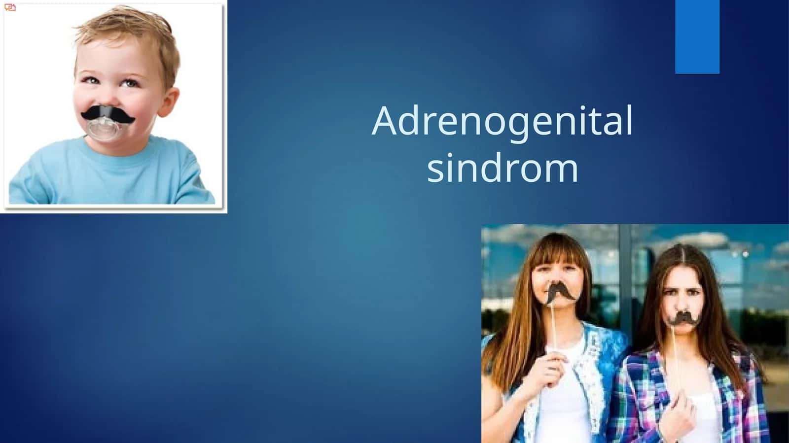 Adrenogenital sindrom 1
