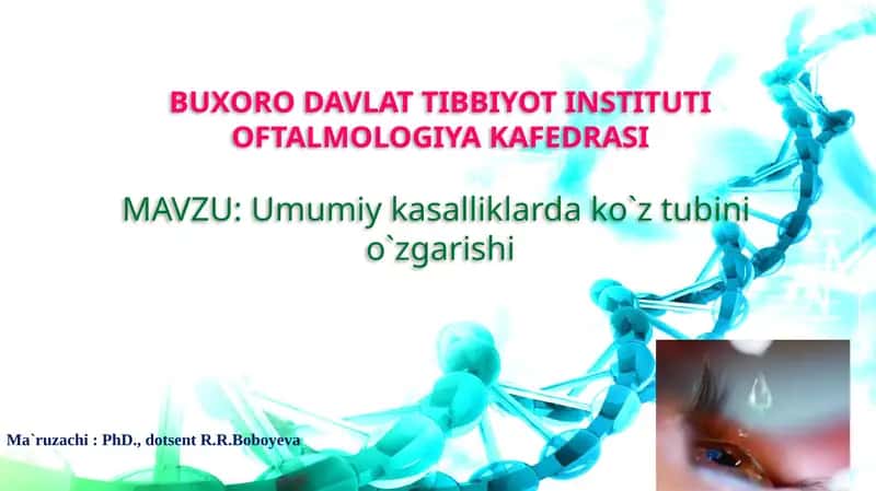Umumiy kasalliklarda ko`z tubinio`zgarishi 1