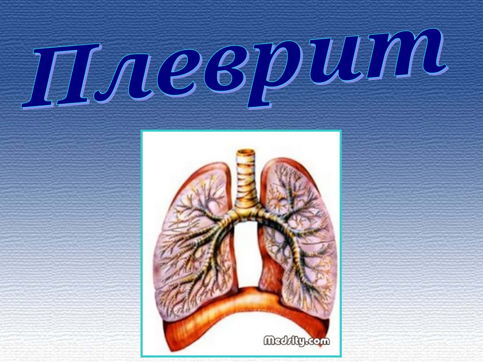 Плеврит. Классификация 1