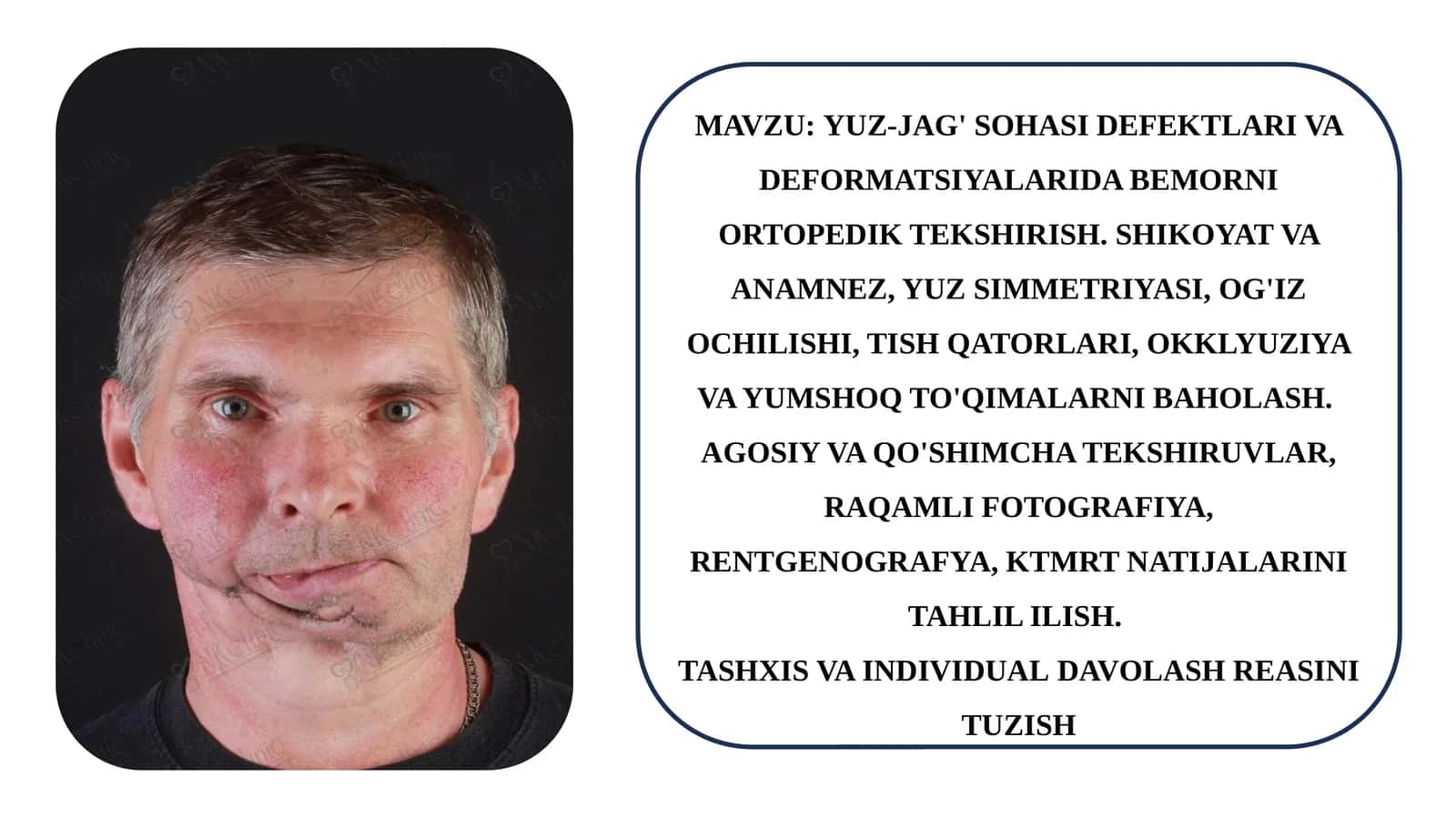 YUZ-JAG' SOHASI DEFEKTLARI VA DEFORMATSIYALARIDA BEMORNI ORTOPEDIK TEKSHIRISH 1