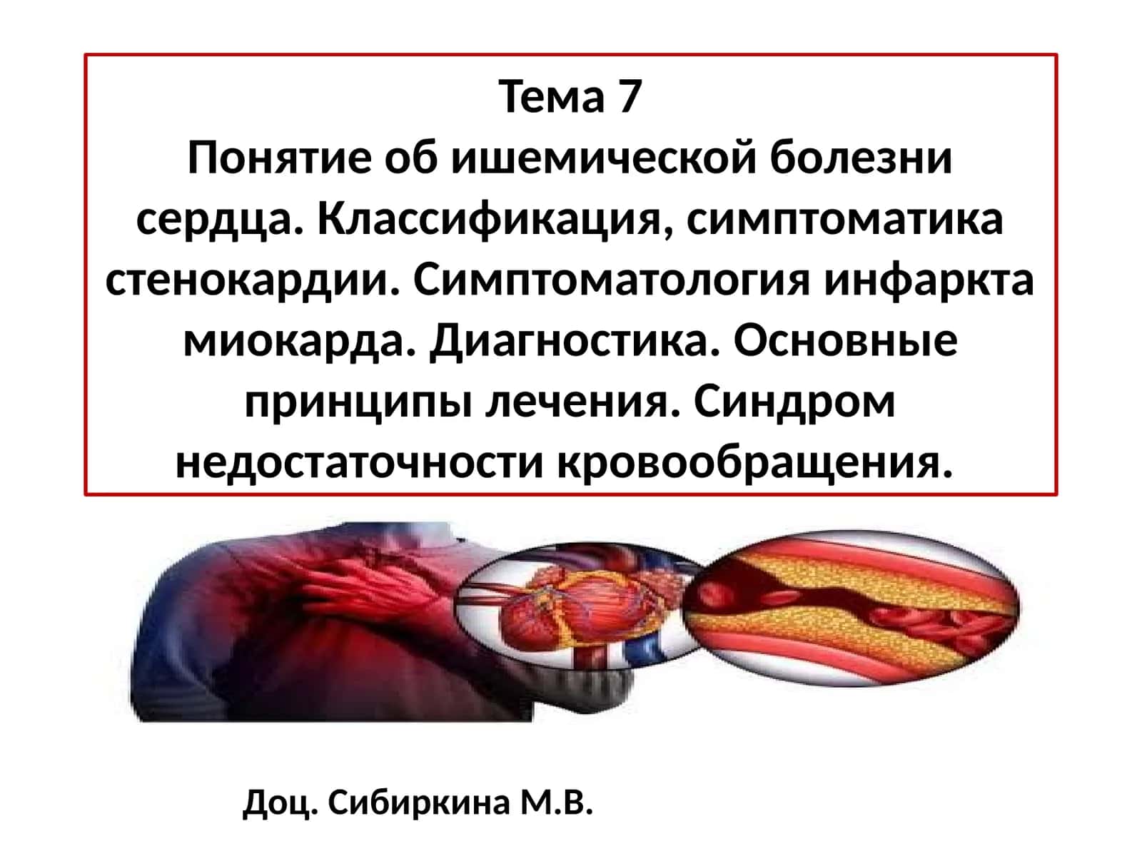 Ишемическая болезнь сердца 1
