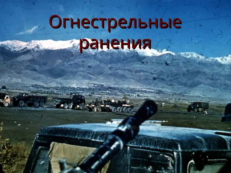Огнестрельные ранения 1