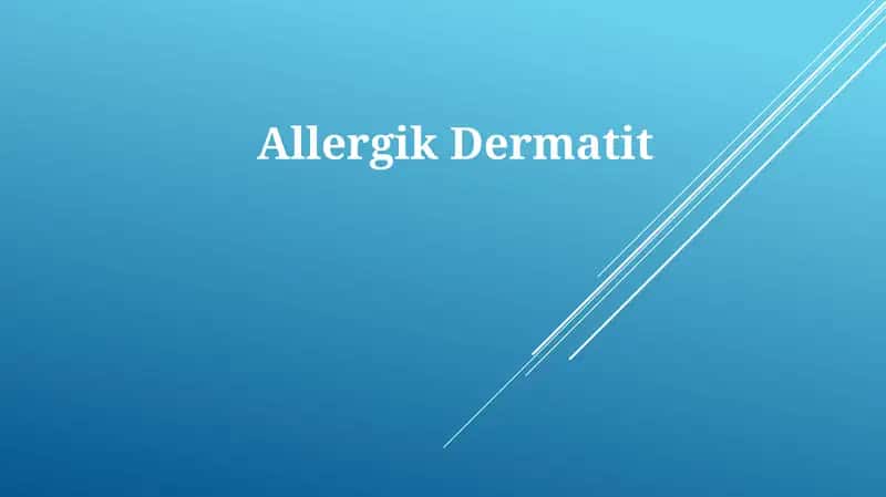 AllergikDermatit 1